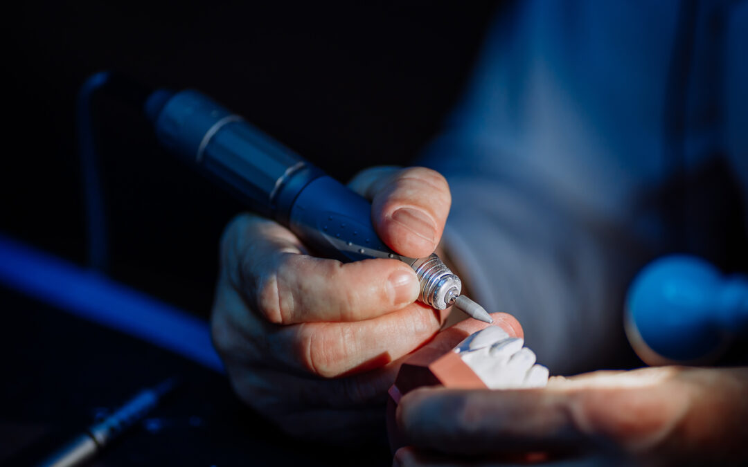 A dental technician using a tool to shape dental partials